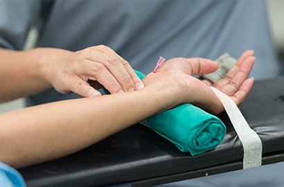 Transradial-Intervention