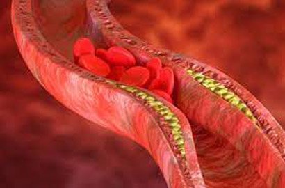 lipidology